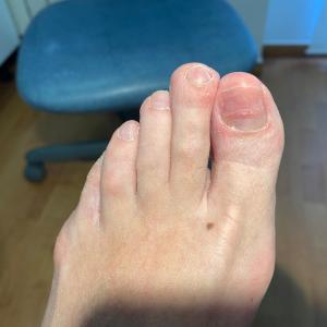 Podología Estética 3